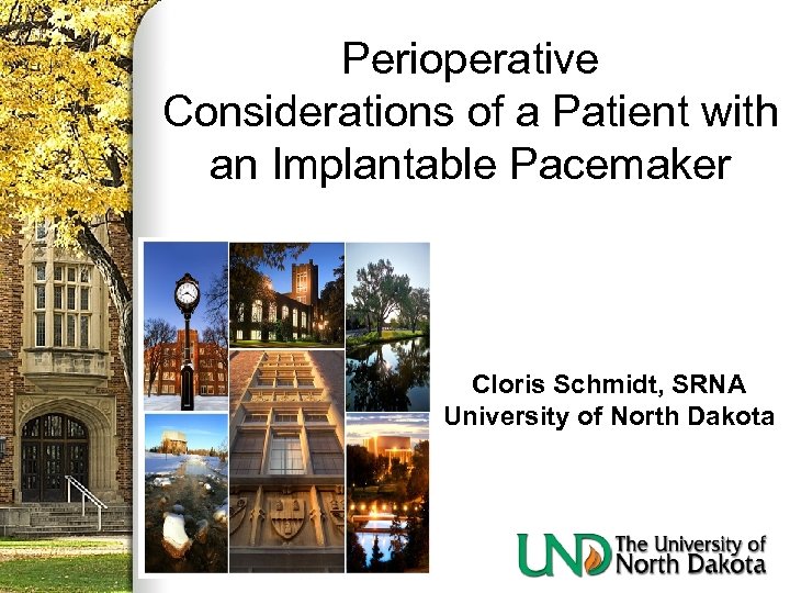 Perioperative Considerations of a Patient with an Implantable Pacemaker Cloris Schmidt, SRNA University of