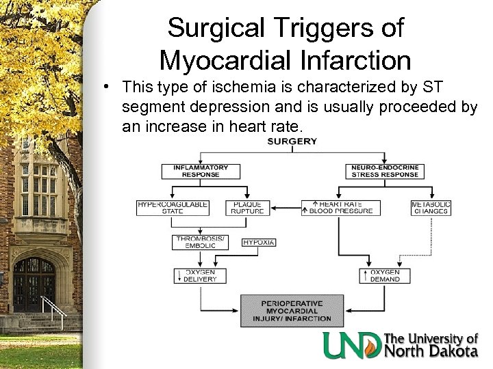 Surgical Triggers of Myocardial Infarction • This type of ischemia is characterized by ST