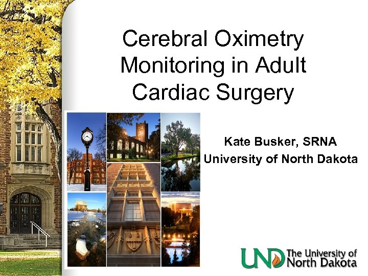 Cerebral Oximetry Monitoring in Adult Cardiac Surgery Kate Busker, SRNA University of North Dakota