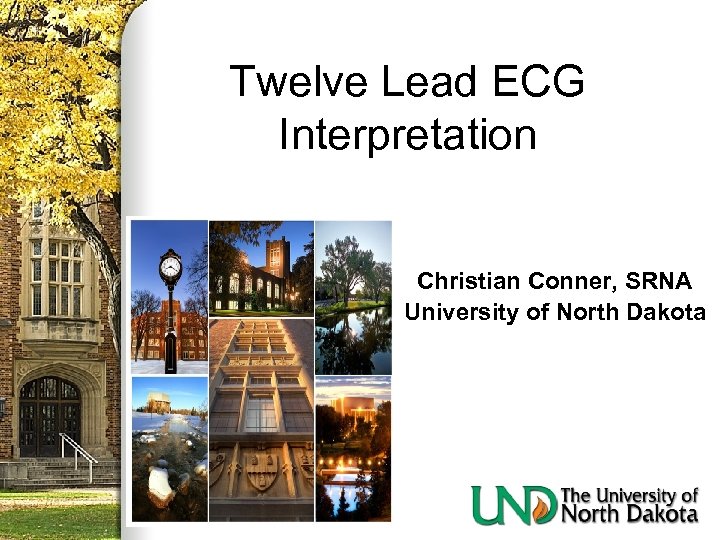 Twelve Lead ECG Interpretation Christian Conner, SRNA University of North Dakota 