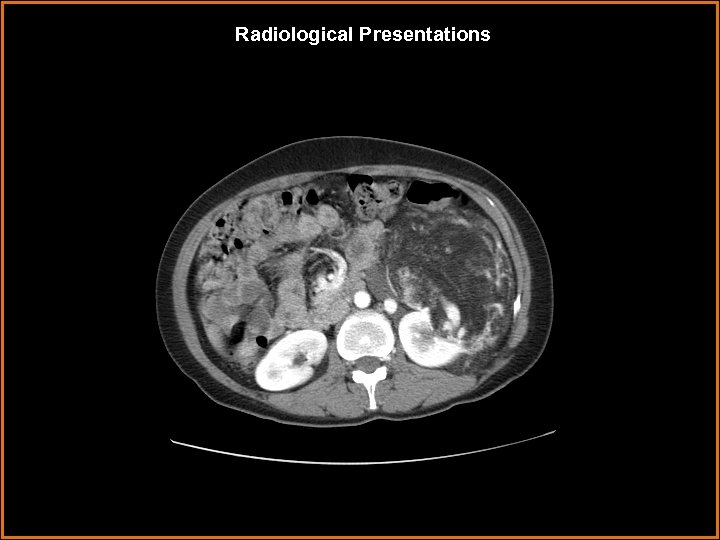 Radiological Presentations 