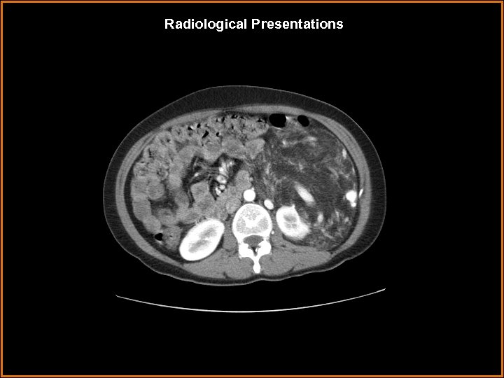 Radiological Presentations 