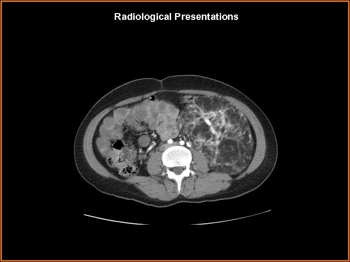 Radiological Presentations 