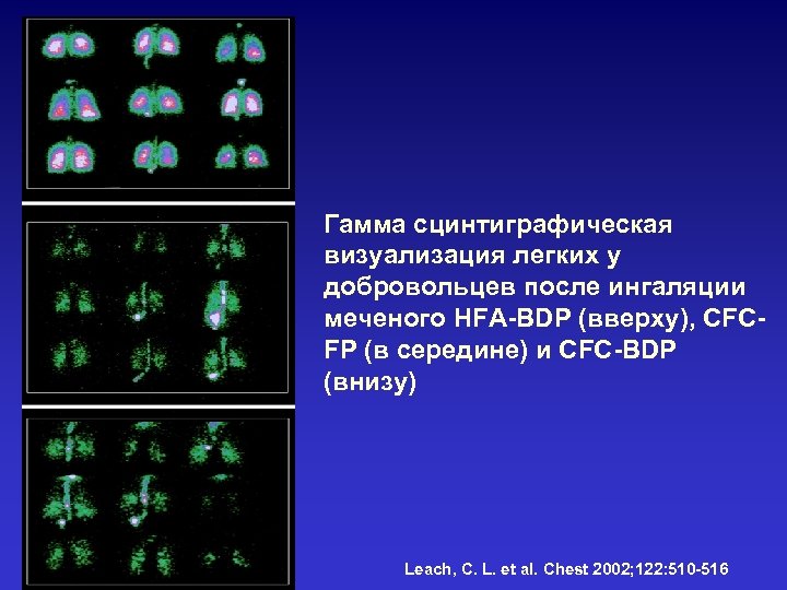 Гамма сцинтиграфическая визуализация легких у добровольцев после ингаляции меченого HFA-BDP (вверху), CFCFP (в середине)