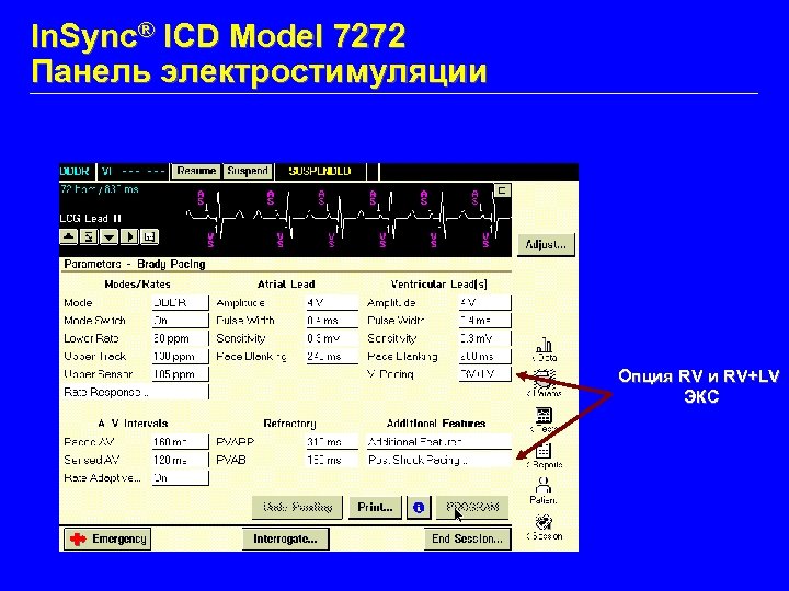 In. Sync® ICD Model 7272 Панель электростимуляции Опция RV и RV+LV ЭКС 