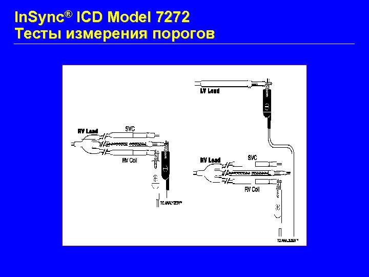 In. Sync® ICD Model 7272 Тесты измерения порогов RV Testing LV Testing 