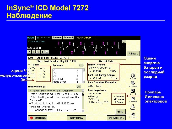 In. Sync® ICD Model 7272 Наблюдение оцени % желудочковой ЭКС Оцени энергию батареи и
