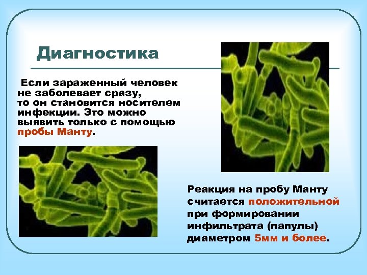 Диагностика Если зараженный человек не заболевает сразу, то он становится носителем инфекции. Это можно