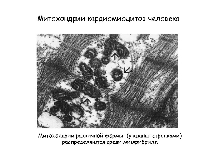 Митохондрии кардиомиоцитов человека Митохондрии различной формы (указаны стрелками) распределяются среди миофибрилл 