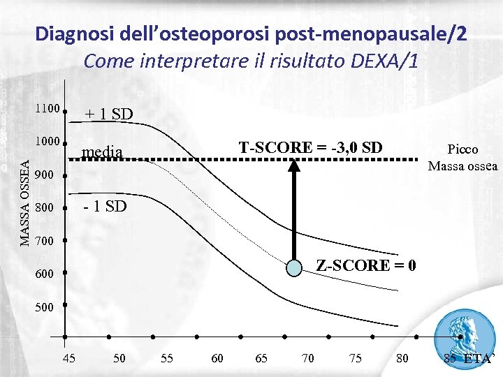 Diagnosi dell’osteoporosi post-menopausale/2 Come interpretare il risultato DEXA/1 1100 + 1 SD MASSA OSSEA