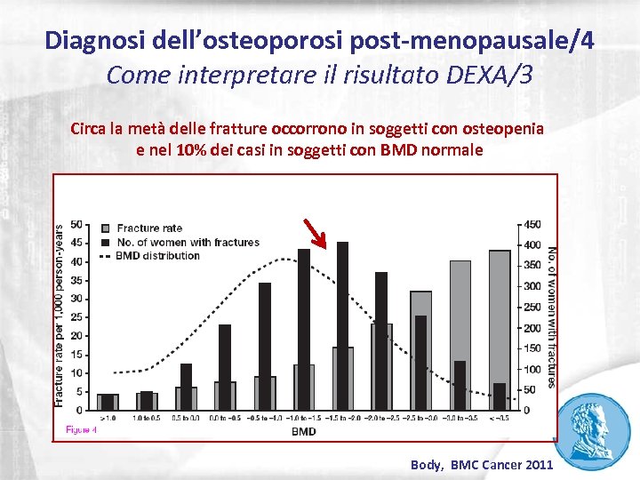 Diagnosi dell’osteoporosi post-menopausale/4 Come interpretare il risultato DEXA/3 Circa la metà delle fratture occorrono