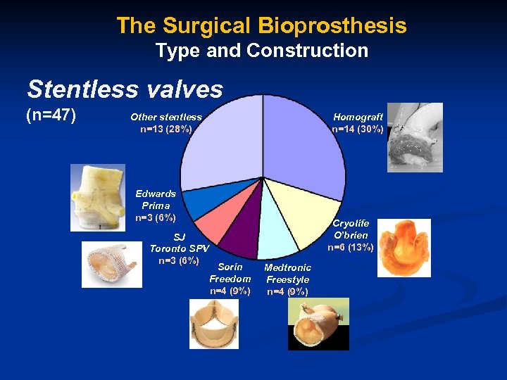 The Surgical Bioprosthesis Type and Construction Stentless valves (n=47) Other stentless n=13 (28%) Homograft