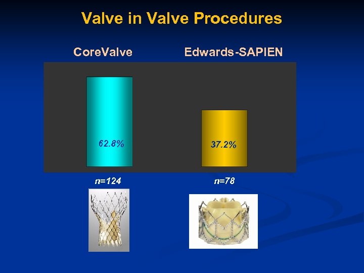 Valve in Valve Procedures Core. Valve 62. 8% n=124 Edwards-SAPIEN 37. 2% n=78 