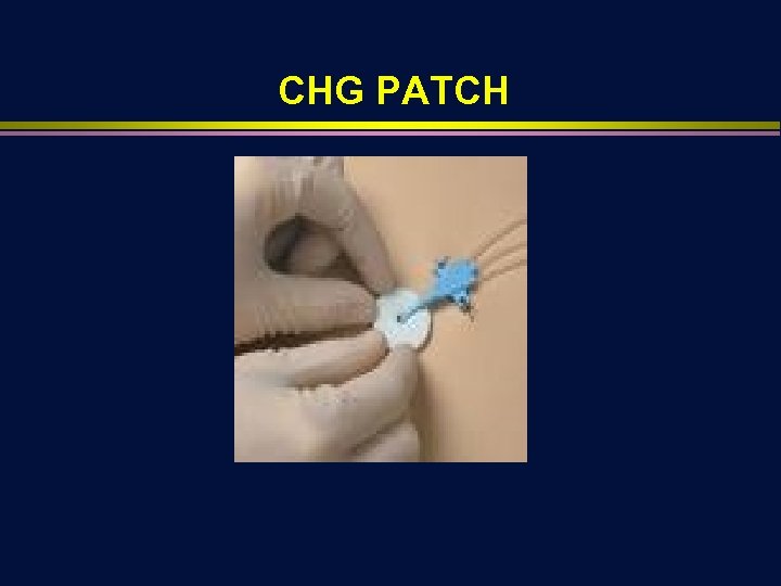 CHG PATCH 
