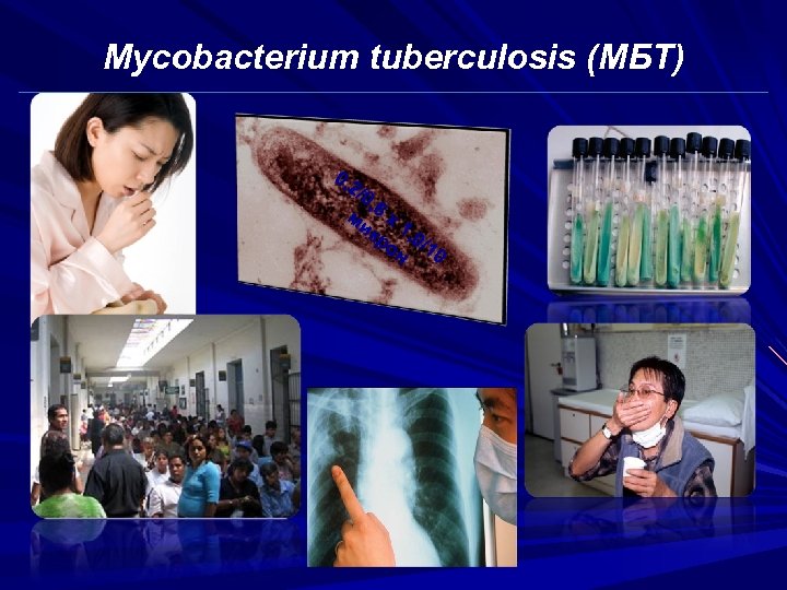 Mycobacterium tuberculosis (МБТ) 0, 2/ 0, ми 6 х кр 1, 0 он /10