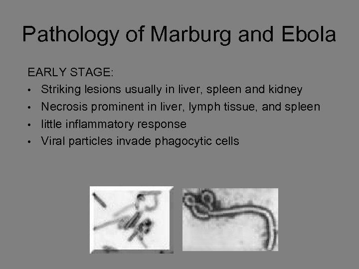 Pathology of Marburg and Ebola EARLY STAGE: • Striking lesions usually in liver, spleen