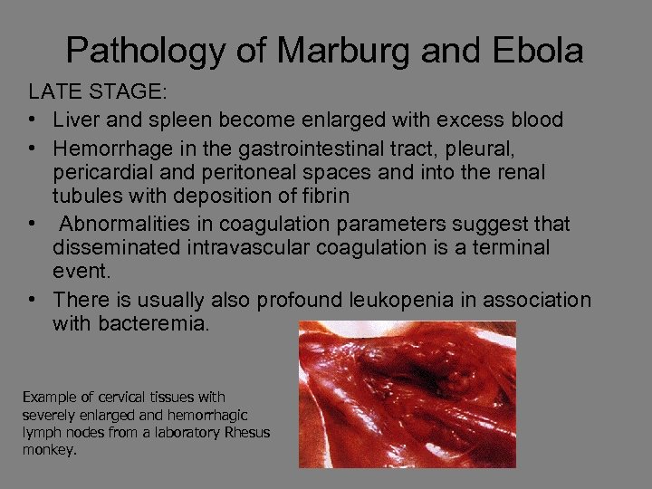 Pathology of Marburg and Ebola LATE STAGE: • Liver and spleen become enlarged with