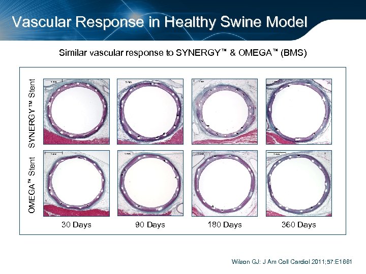 Vascular Response in Healthy Swine Model OMEGA™ Stent SYNERGY™ Stent Similar vascular response to