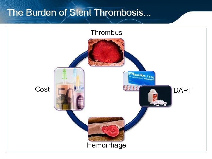 The Burden of Stent Thrombosis. . . Thrombus Cost DAPT Hemorrhage 