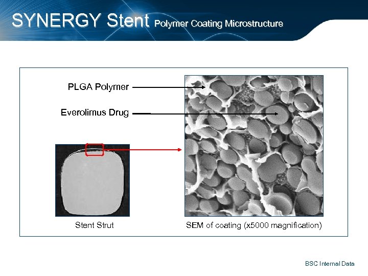 SYNERGY Stent Polymer Coating Microstructure PLGA Polymer Everolimus Drug Stent Strut SEM of coating