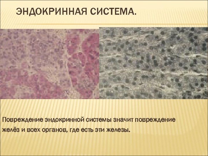 ЭНДОКРИННАЯ СИСТЕМА. Повреждение эндокринной системы значит повреждение желёз и всех органов, где есть эти