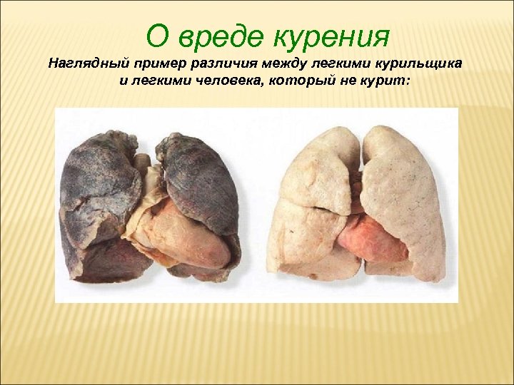 О вреде курения Наглядный пример различия между легкими курильщика и легкими человека, который не