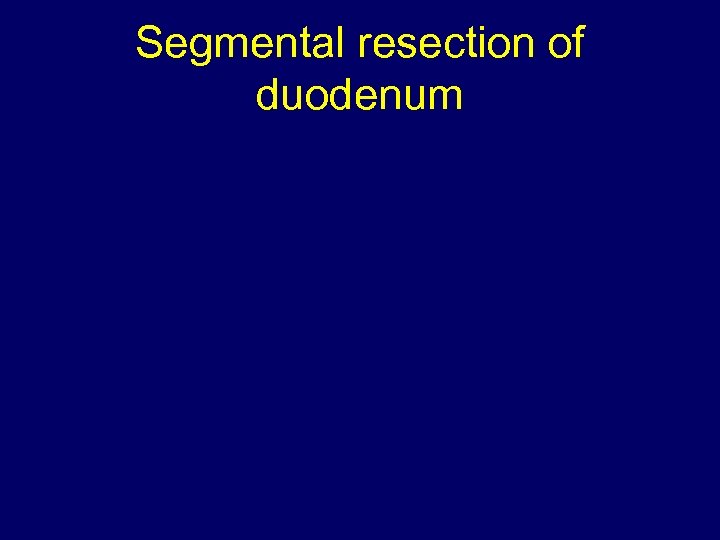 Segmental resection of duodenum 