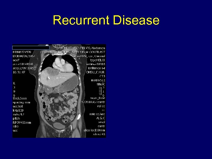 Recurrent Disease 