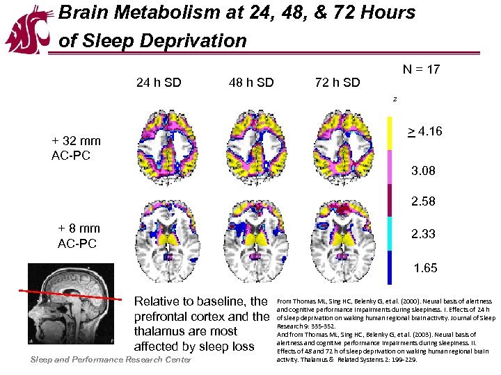 Brain Metabolism at 24, 48, & 72 Hours of Sleep Deprivation 24 h SD
