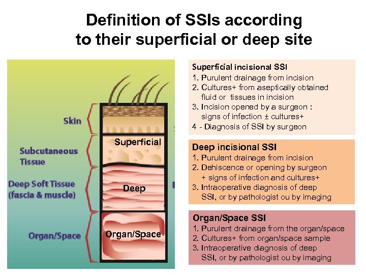 Definition of SSIs according to their superficial or deep site Superficial incisional SSI 1.