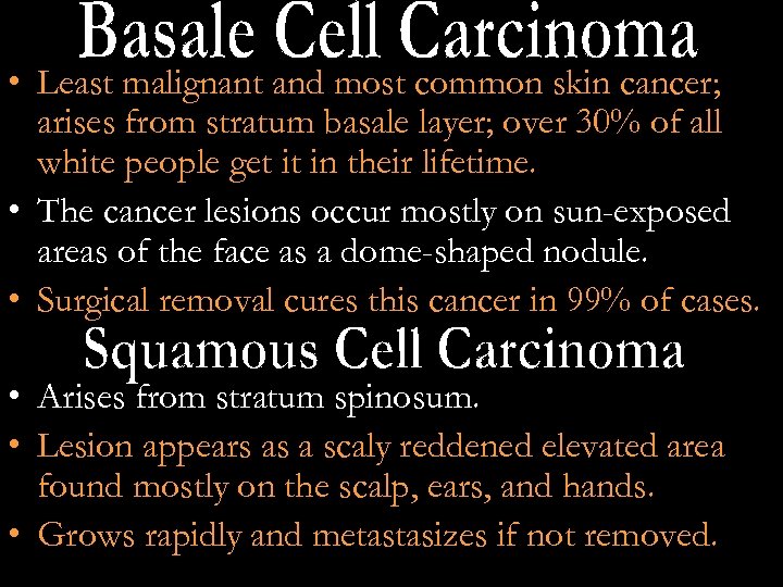  • Least malignant and most common skin cancer; arises from stratum basale layer;