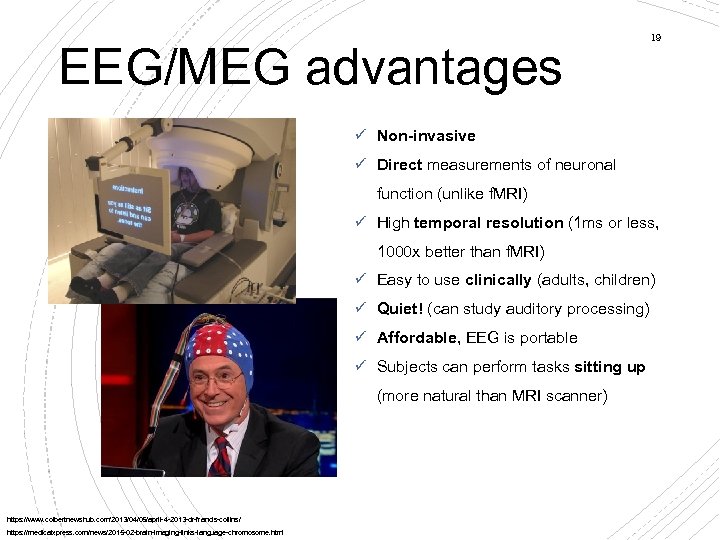 EEG/MEG advantages 19 Non-invasive Direct measurements of neuronal function (unlike f. MRI) High temporal