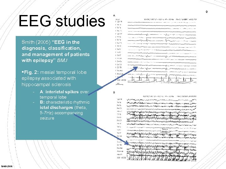EEG studies Smith (2005) “EEG in the diagnosis, classification, and management of patients with