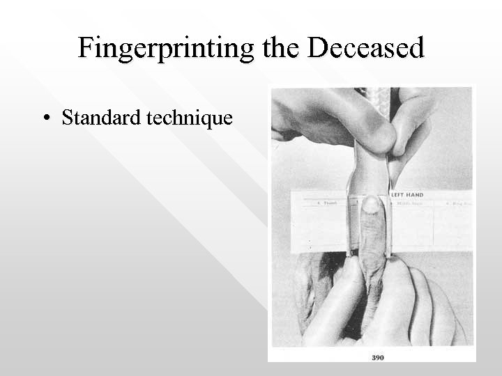 Fingerprinting the Deceased • Standard technique 