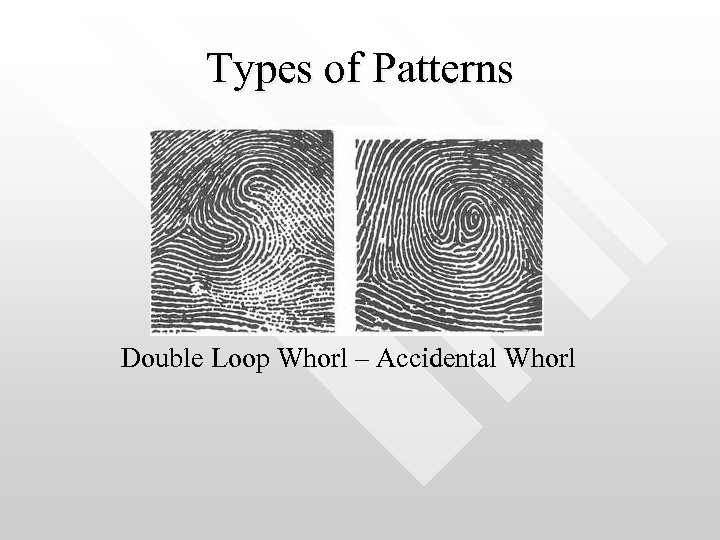 Types of Patterns Double Loop Whorl – Accidental Whorl 