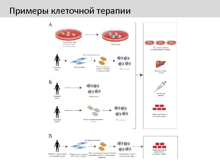 Примеры клеточной терапии 