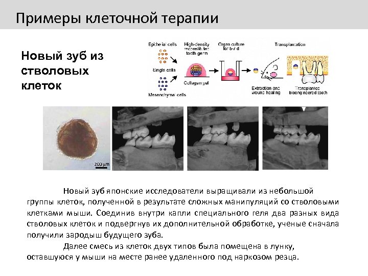 Примеры клеточной терапии Новый зуб из стволовых клеток Новый зуб японские исследователи выращивали из