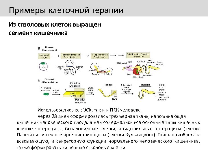 Примеры клеточной терапии Из стволовых клеток выращен сегмент кишечника Использовались как ЭСК, так и