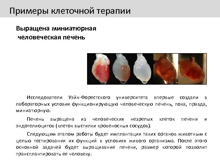 Примеры клеточной терапии Выращена миниатюрная человеческая печень Исследователи Уэйк-Форестского университета впервые создали в лабораторных