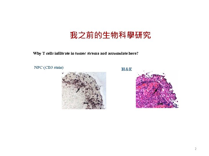 我之前的生物科學研究 Why T cells infiltrate in tumor stroma and accumulate here? NPC (CD 3