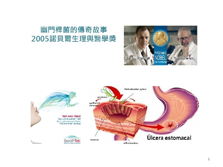 幽門桿菌的傳奇故事 2005諾貝爾生理與醫學獎 6 