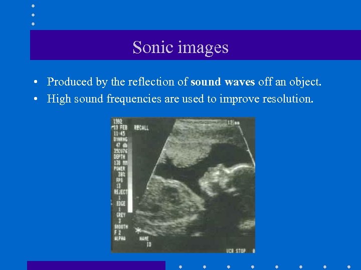 Sonic images • Produced by the reflection of sound waves off an object. •