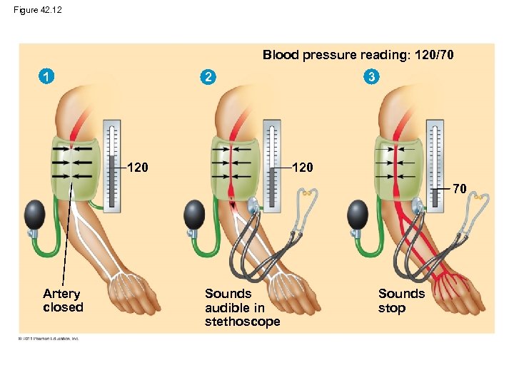 Figure 42. 12 Blood pressure reading: 120/70 1 3 2 120 70 Artery closed