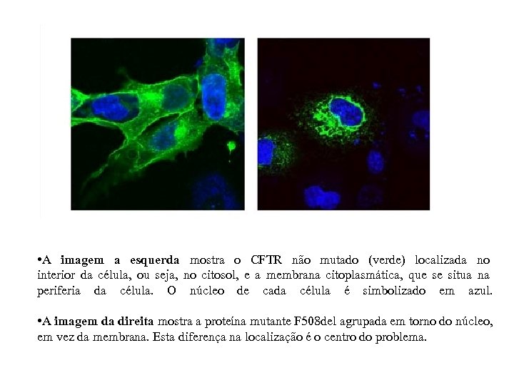  • A imagem a esquerda mostra o CFTR não mutado (verde) localizada no