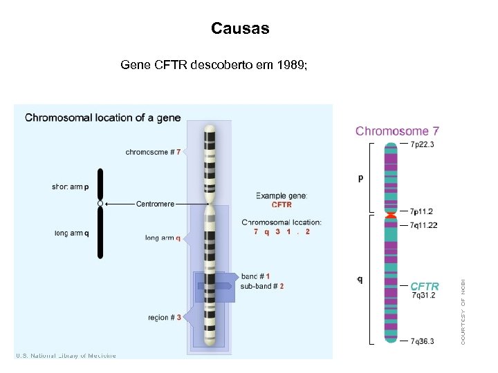 Causas Gene CFTR descoberto em 1989; 