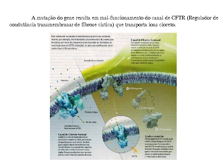 A mutação do gene resulta em mal-funcionamento do canal de CFTR (Regulador de condutância