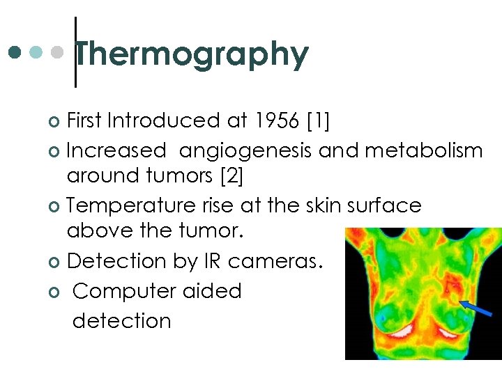Thermography First Introduced at 1956 [1] ¢ Increased angiogenesis and metabolism around tumors [2]
