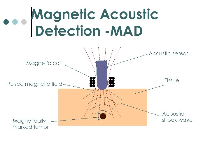 Magnetic Acoustic Detection -MAD Acoustic sensor Magnetic coil Pulsed magnetic field Magnetically marked tumor