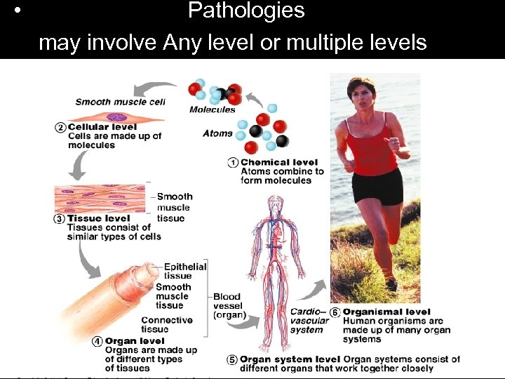  • Pathologies may involve Any level or multiple levels 