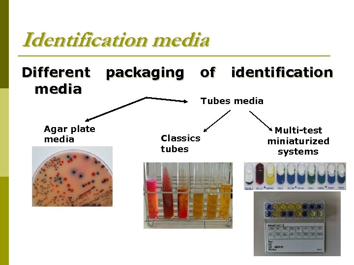 Identification media Different packaging of identification media Tubes media Agar plate media Classics tubes